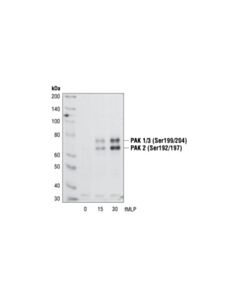 Cell Signaling Phospho-Pak1 (Ser199/204)/Pak2 (Ser192/197) Antibody
