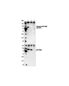 Cell Signaling Phospho-Pak1 (Ser144)/Pak2 (Ser141) Antibody