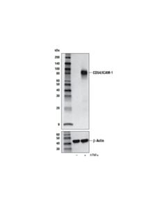 Cell Signaling Cd54/Icam-1 (E3q9n) Xp Rabbit mAb (Bsa And Azide Free)