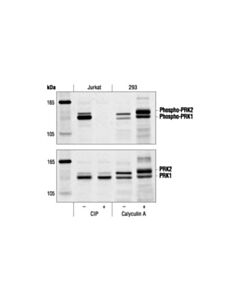 Cell Signaling Phospho-Prk1 (Thr774)/Prk2 (Thr816) Antibody