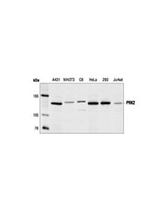 Cell Signaling Prk2 Antibody