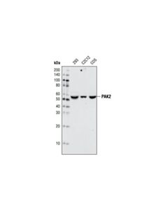 Cell Signaling Pak2 (C17a10) Rabbit mAb