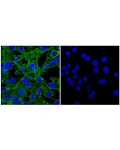 Cell Signaling Cd34 (E2j1k) Rabbit mAb