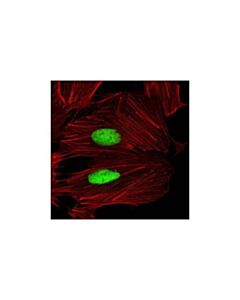 Cell Signaling Hp1alpha/Beta (C7f11) Rabbit mAb