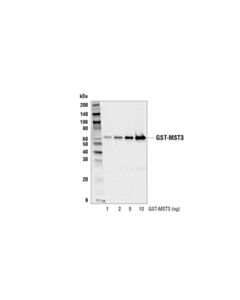 Cell Signaling Gst (91g1) Rabbit mAb