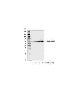 Cell Signaling Gst (91g1) Rabbit mAb
