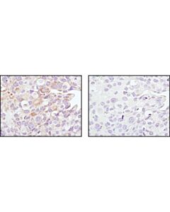 Cell Signaling Sirt3 (C73e3) Rabbit mAb