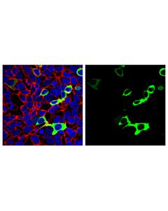 Cell Signaling Sars-Cov-2 Nucleocapsid Protein (Hl344) Rabbit mAb