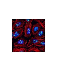 Cell Signaling Fibrillarin (C13c3) Rabbit mAb