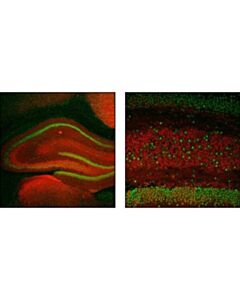 Cell Signaling Alpha/Beta-Synuclein (Syn205) Mouse mAb