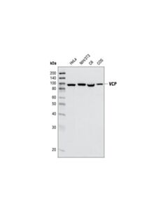 Cell Signaling Vcp (7f3) Rabbit mAb