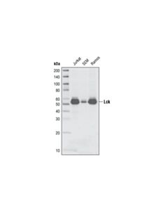 Cell Signaling Lck (L22b1) Mouse mAb