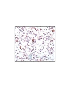 Cell Signaling Phospho-Chk2 (Ser19) Antibody