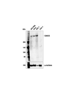 Cell Signaling Casc5 (E4a5l) Rabbit mAb