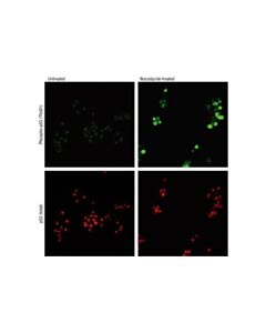 Cell Signaling Phospho-P53 (Thr81) Antibody