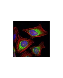 Cell Signaling Calnexin (C5c9) Rabbit mAb