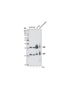 Cell Signaling p35/25 (C64B10) Rabbit mAb 20 uL