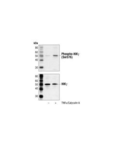 Cell Signaling Phospho-Ikkgamma (Ser376) Antibody