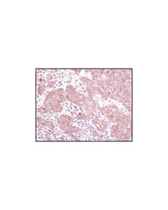 Cell Signaling Pras40 (D23c7) Xp Rabbit mAb