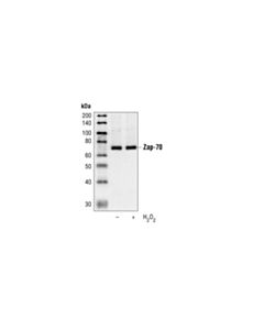 Cell Signaling Zap-70 (99F2) Rabbit mAb 20 uL