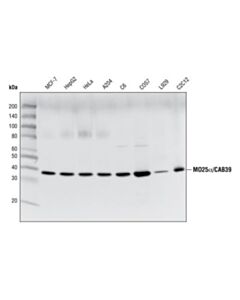 Cell Signaling Mo25alpha/Cab39 (C49d8) Rabbit mAb