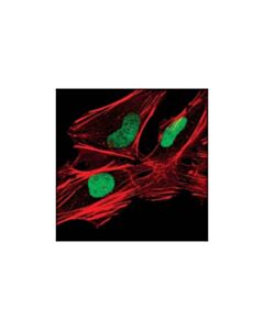 Cell Signaling Xrcc1 Antibody