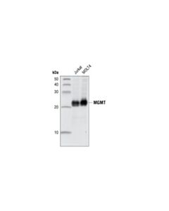 Cell Signaling Mgmt Antibody