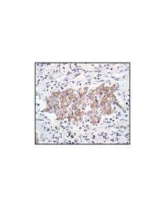 Cell Signaling Bcl-Xl (54h6) Rabbit mAb