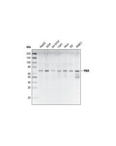 Cell Signaling Pkr (N216) Antibody