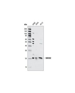 Cell Signaling Socs2 Antibody
