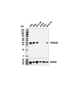 Cell Signaling Phox2b (E4q9r) Rabbit mAb