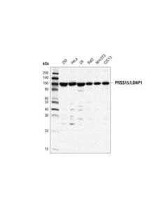 Cell Signaling Prss15/Lonp1 (D8w1j) Rabbit mAb