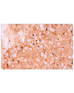 Cell Signaling S100b (E9f2i) Rabbit mAb