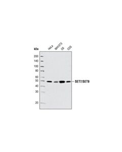 Cell Signaling Set7/Set9 (C24b1) Rabbit mAb