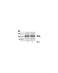 Cell Signaling Cpla2 Antibody