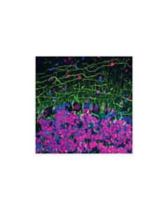 Cell Signaling Neurofilament-L (Da2) Mouse mAb