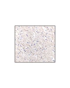 Cell Signaling Neurofilament-M (Rmo 14.9) Mouse mAb