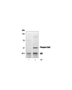 Cell Signaling Phospho-(Ser/Thr) Atm/Atr Substrate Antibody
