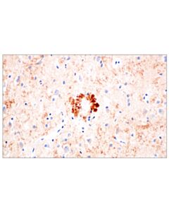 Cell Signaling BACE1 (F4Z7X) Rabbit mAb 20 uL