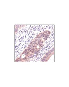 Cell Signaling Phospho-4e-Bp1 (Thr37/46) (236b4) Rabbit mAb