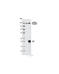 Cell Signaling P190-A Rhogap (C59f7) Rabbit mAb