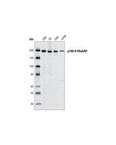 Cell Signaling p190-A RhoGAP (C59F7) Rabbit mAb 20 uL