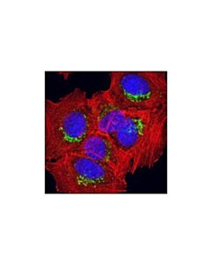 Cell Signaling Syntaxin 6 (C34b2) Rabbit mAb