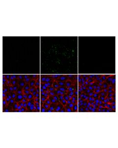 Cell Signaling Dsrna (K1) Mouse mAb