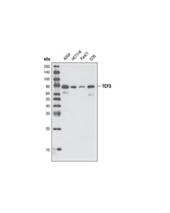 Cell Signaling Tcf3/Tcf7l1 (D15g11) Rabbit mAb