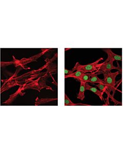 Cell Signaling Irf-9 (D9i5h) Rabbit mAb (Mouse Specific)