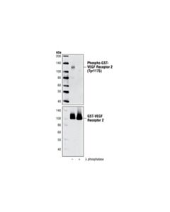 Cell Signaling Vegf Receptor 2 Control Proteins