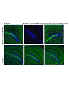 Cell Signaling Phosphoplus Alpha-Synuclein (Ser129) Antibody Duet