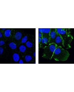 Cell Signaling Phospho-Catenin Delta-1 (Tyr228) Antibody