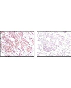 Cell Signaling Akt (Pan) (40d4) Mouse mAb
